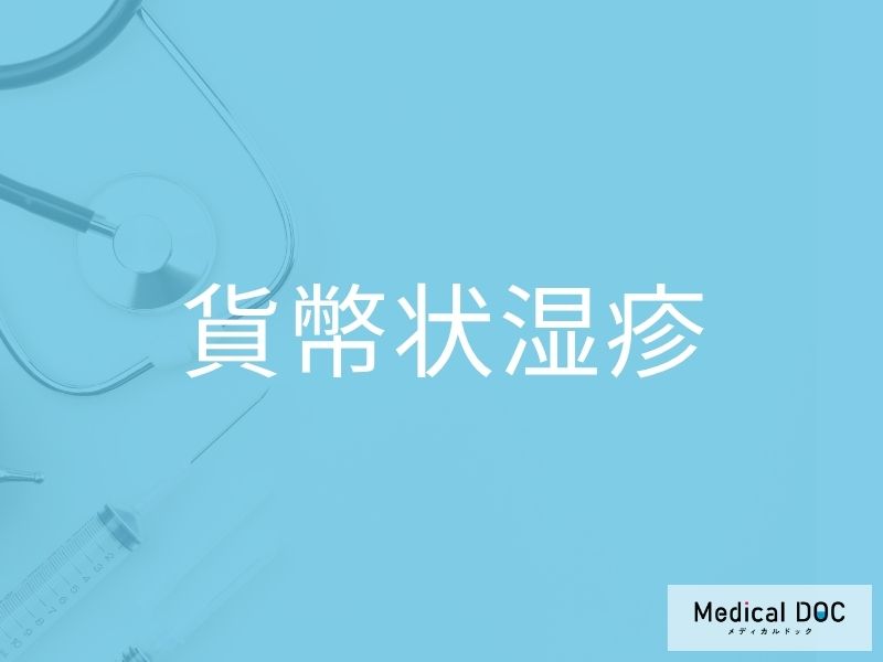 貨幣状湿疹
