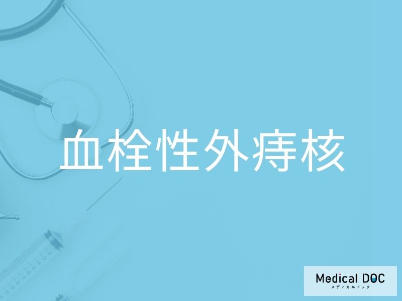 血栓性外痔核