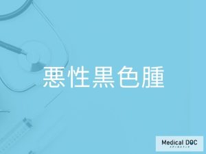 悪性黒色腫
