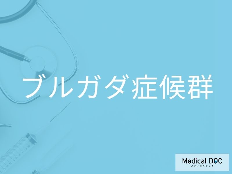 ブルガダ症候群