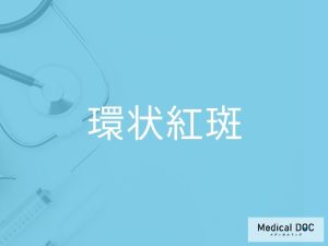 環状紅斑
