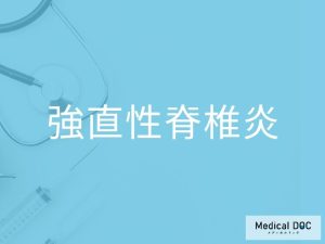 強直性脊椎炎