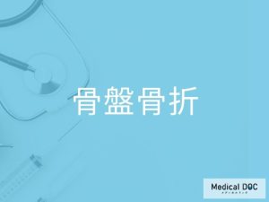 骨盤骨折