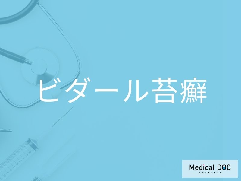 ビダール苔癬