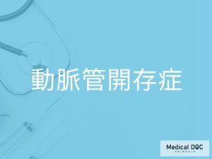 動脈管開存症