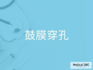 鼓膜穿孔