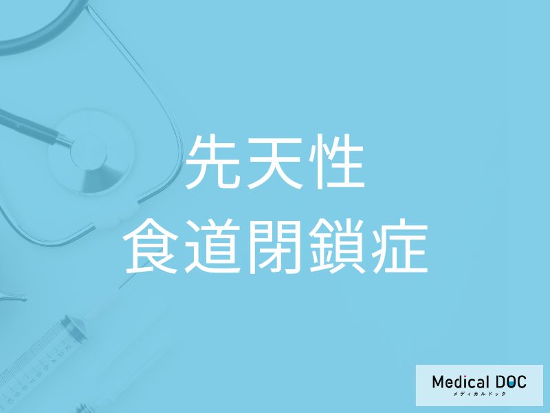 先天性食道閉鎖症