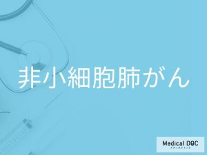 非小細胞肺がん