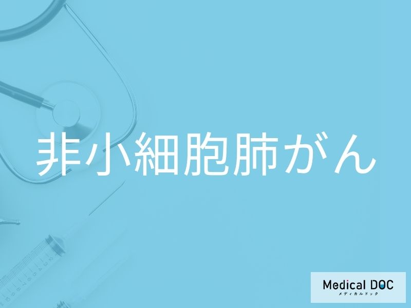 非小細胞肺がん