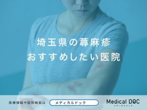 埼玉県の蕁麻疹おすすめしたい医院