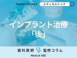 インプラント治療直後から硬い物は食べれる? 手術後の経過と必要なケアを歯科医が解説
