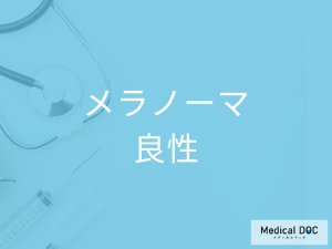 「良性のほくろとメラノーマ」の見分け方はご存知ですか？発症しやすい部位も解説！
