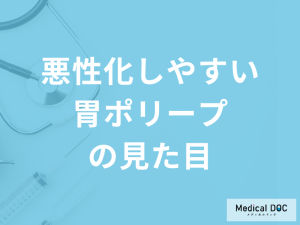 ”悪性化”しやすい「胃ポリープの見た目」は？進行時の症状も医師が解説！