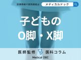 子どものO脚・X脚、もしかしたら病気かも? 原因や治療法、放置するリスクを医師が解説!