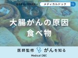 非公開: 「大腸がんの原因」となる可能性の高い超加工食品はご存知ですか？医師が解説！