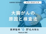 非公開: 「大腸がんの原因や検査法」はご存知ですか？医師が徹底解説！
