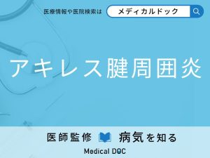 アキレス腱周囲炎