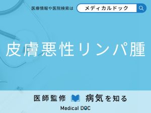 皮膚悪性リンパ腫