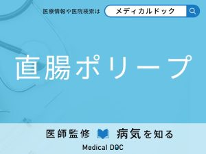 直腸ポリープ