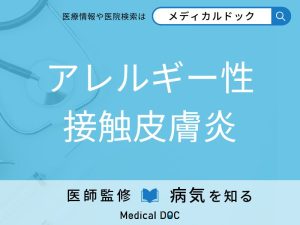 アレルギー性接触皮膚炎