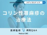 非公開: 「コリン性蕁麻疹」の治療法はご存知ですか？自分で出来る対処法も解説！