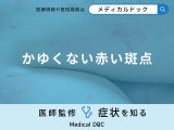 非公開: 「かゆくない赤い斑点」ができる原因をご存知ですか？医師が徹底解説！