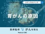 非公開: 「胃がんの原因」となる可能性の高い食べ物はご存知ですか？【医師監修】