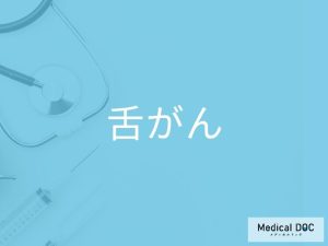 舌がん