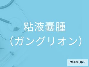 粘液嚢腫（ガングリオン）