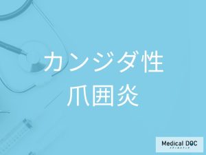 カンジダ性爪囲炎