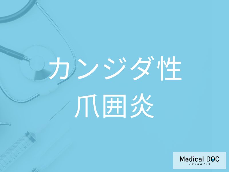 カンジダ性爪囲炎