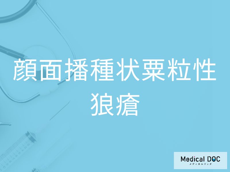 顔面播種状粟粒性狼瘡