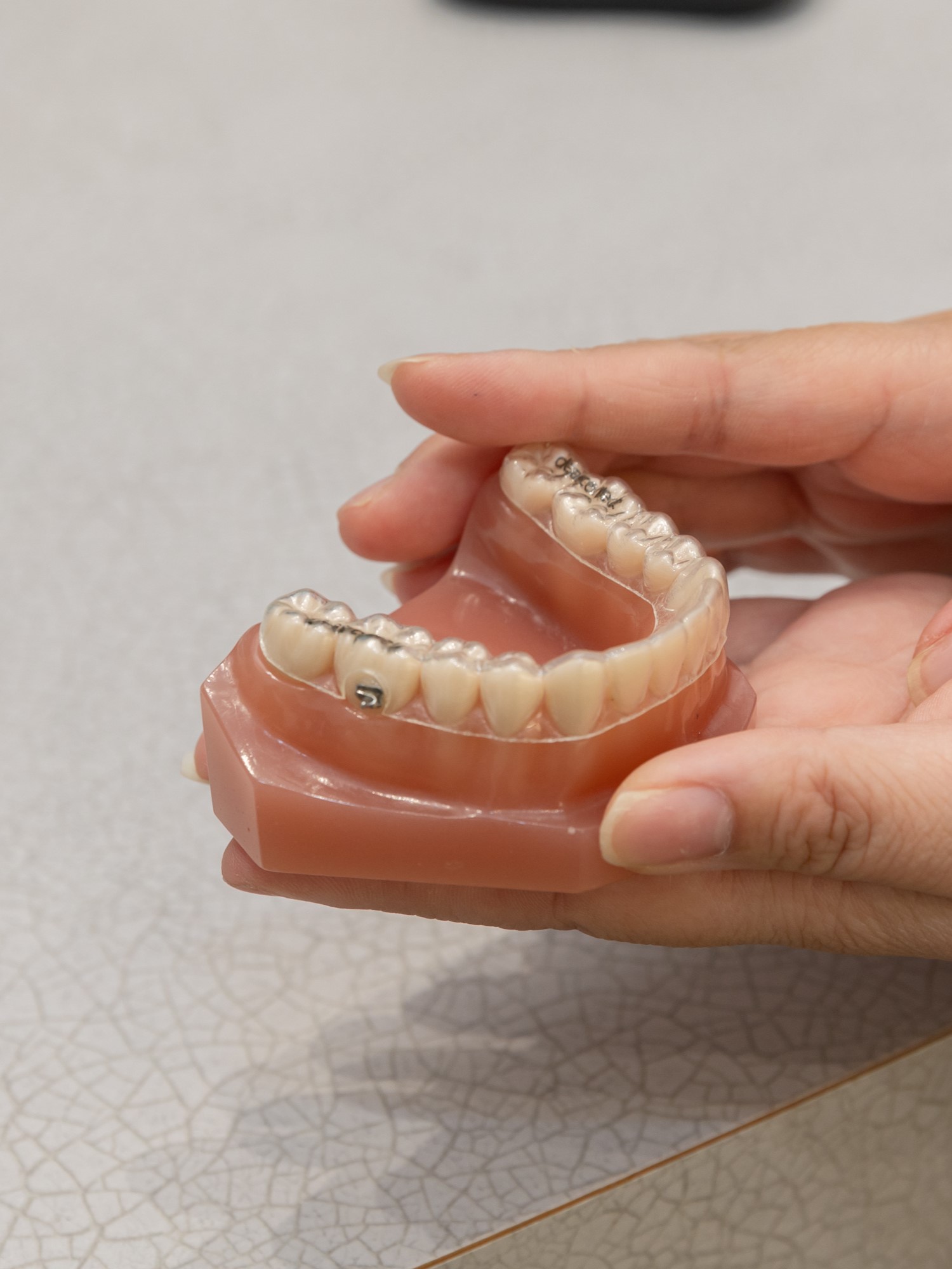 患者さん一人ひとりに合わせ、費用を抑えたインハウスアライナー