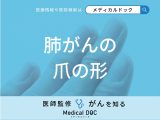 「肺がん」を発症すると「爪の形」はどのように変化する？医師が徹底解説！