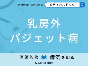 乳房外パジェット病