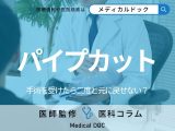 「パイプカット」したら二度と元に戻せない? デメリット・手術の流れを医師が解説!
