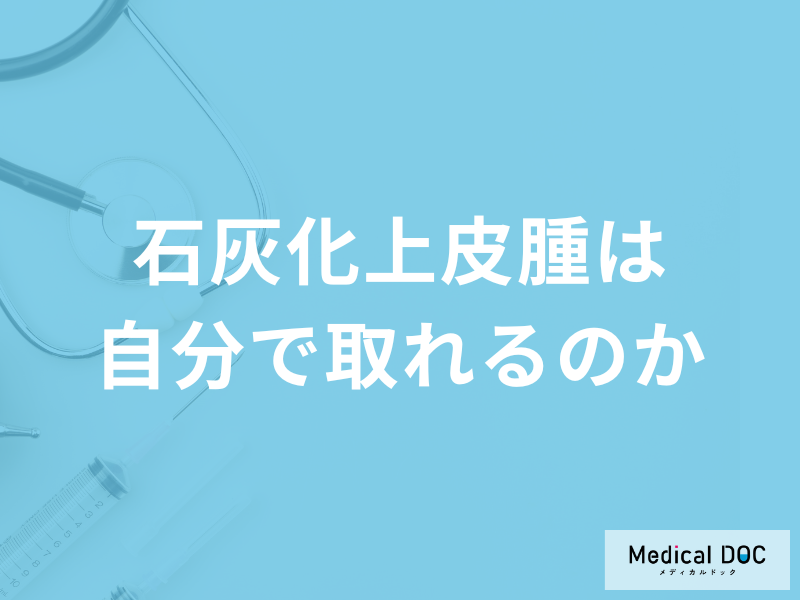 「石灰化上皮腫」は自分で取ることは可能なのか？再発についても医師が確認！