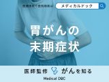 「胃がんの末期症状」はご存知ですか？なりやすい人の特徴も医師が徹底解説！