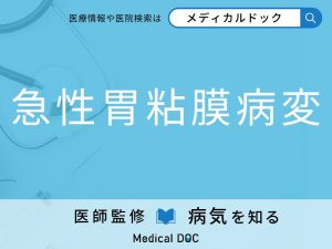 急性胃粘膜病変