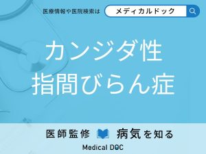 カンジダ性指間びらん症