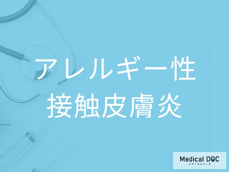 アレルギー性接触皮膚炎