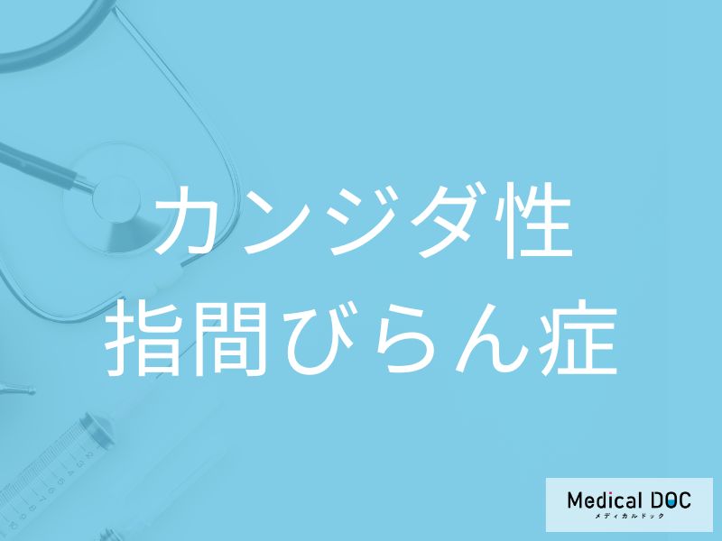 カンジダ性指間びらん症