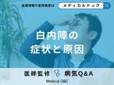 非公開: 「白内障」を疑う初期症状はご存知ですか？発症しやすい人の特徴も解説！【医師監修】