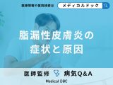 非公開: 「脂漏性皮膚炎」を発症しやすいのは30代や40代？【医師監修】