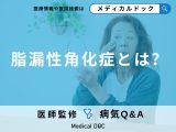 非公開: 「脂漏性角化症」について医師が監修！シミやいぼで悩んでいませんか？