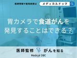 「胃カメラで食道がんを発見」できる？初期症状についても解説！【医師監修】