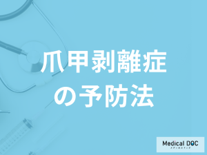 「爪甲剥離症の予防法」は何かご存知ですか？早期発見のポイントも医師が解説！