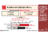 「胃がん」はカドニリマブと化学療法の併用で高い治療効果 生存期間の延長を確認