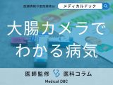 非公開: 大腸がんを見つける「大腸カメラ」では何をするかご存じですか? 検査の流れを医師が解説!