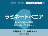 「ラミネートベニア」が向いている人の特徴はご存じですか? 費用や注意点、メリット・デメリットも歯科医が解説!